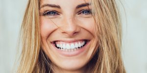 Brighten Your Smile with Newstead Professional Teeth Whitening