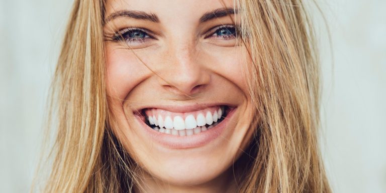 Brighten Your Smile with Newstead Professional Teeth Whitening